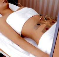 Миостимуляция